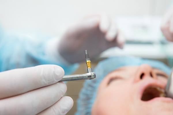 A dentist holding a dental implant