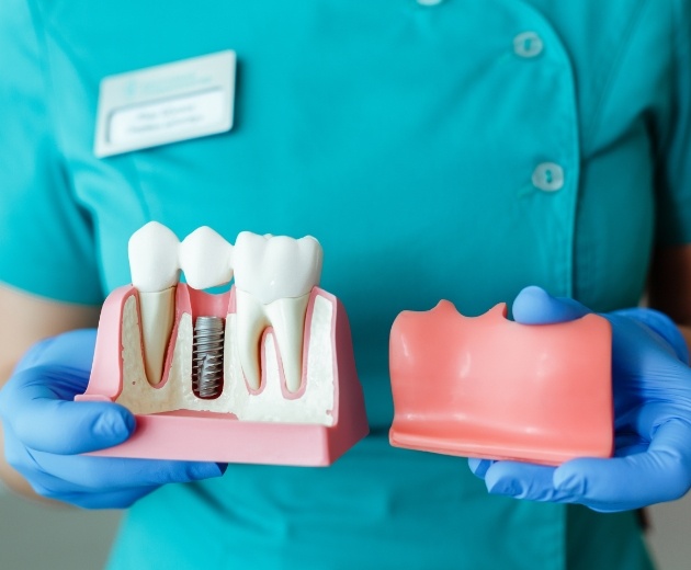 Oral surgeon holding a model of the gums with a dental implant in one hand and a model of toothless gums in the other